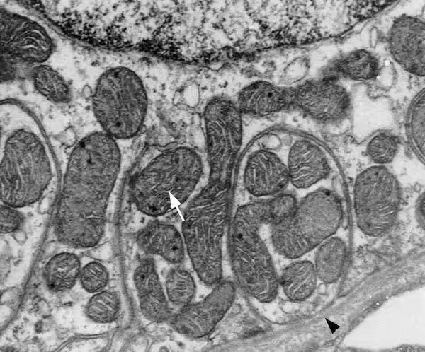 易科学-生物透射电镜TEM--动物植物微生物及致病菌(武汉委托测试)_仪器共享_易科学